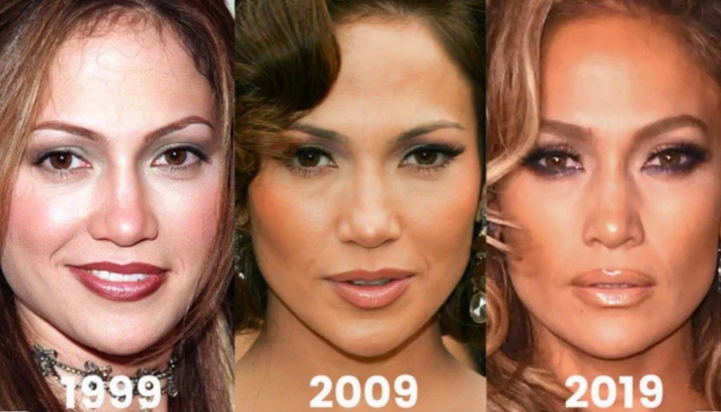 Pristup pomlađivanju koji koristi i Jennifer Lopez!