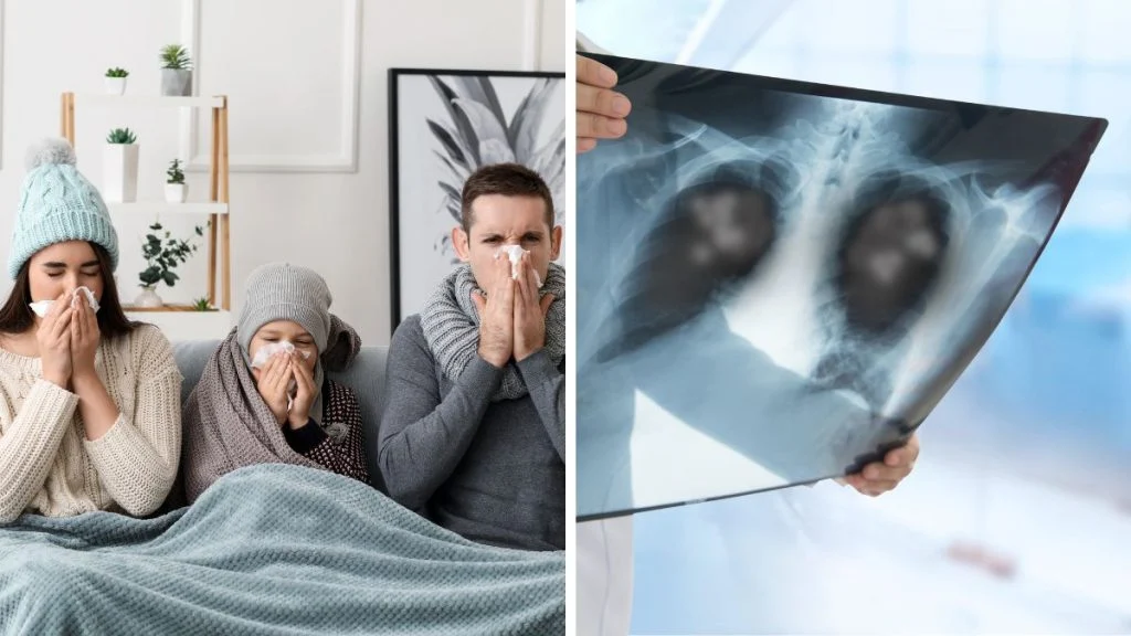 Komplikacije gripe: Kako gripa može utjecati na zdravlje cijelog organizma?