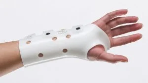 Tijekom ljeta raste broj dječjih prijeloma: plastični gips omogućuje bezbrižniji oporavak